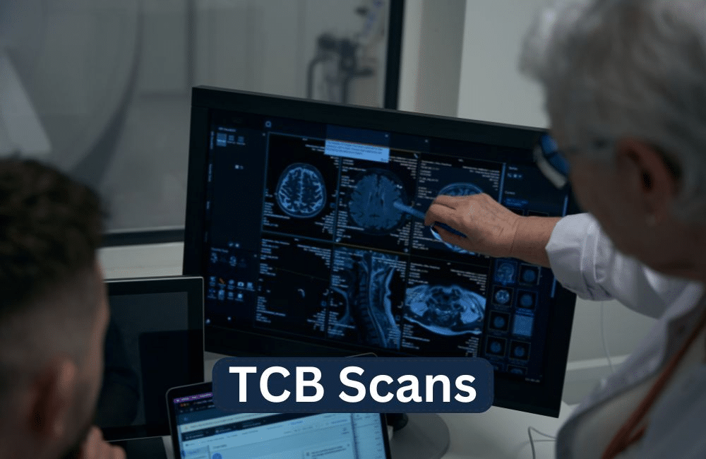 TCB Scans: What You Need to Know